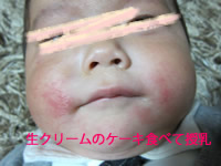 赤ちゃん治療口周り食べ物アレルギー画像生後6ケ月